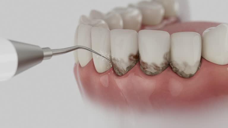 Trusted Dental Implants service in Granite Quarry, NC - Dentist Open Now